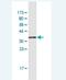 High Mobility Group AT-Hook 1 antibody, H00003159-M03, Novus Biologicals, Western Blot image 