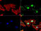 O-6-Methylguanine-DNA Methyltransferase antibody, LS-C796817, Lifespan Biosciences, Immunofluorescence image 