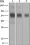 Interferon Alpha And Beta Receptor Subunit 1 antibody, GTX14637, GeneTex, Western Blot image 