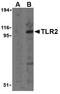 Toll Like Receptor 2 antibody, MBS395815, MyBioSource, Western Blot image 