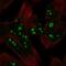 HERPUD Family Member 2 antibody, NBP2-55896, Novus Biologicals, Immunofluorescence image 