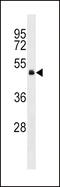 G Protein Subunit Alpha 13 antibody, 58-901, ProSci, Western Blot image 