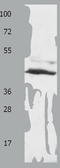 Solute Carrier Family 16 Member 7 antibody, TA321668, Origene, Western Blot image 