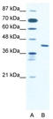 Zinc Finger Protein 621 antibody, TA330615, Origene, Western Blot image 