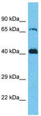 Secretion Regulating Guanine Nucleotide Exchange Factor antibody, TA331999, Origene, Western Blot image 