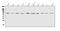 Interleukin 2 Receptor Subunit Gamma antibody, A00308-1, Boster Biological Technology, Western Blot image 