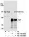 BAF Chromatin Remodeling Complex Subunit BCL11A antibody, NB100-585, Novus Biologicals, Western Blot image 