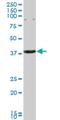 Capping Actin Protein Of Muscle Z-Line Subunit Alpha 3 antibody, H00093661-M01, Novus Biologicals, Western Blot image 