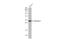 Galectin 3 antibody, GTX125897, GeneTex, Western Blot image 