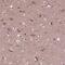 RUN And FYVE Domain Containing 3 antibody, PA5-54651, Invitrogen Antibodies, Immunohistochemistry frozen image 