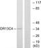 Olfactory Receptor Family 13 Subfamily C Member 4 antibody, GTX87620, GeneTex, Western Blot image 