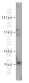 Parvin Gamma antibody, 13284-1-AP, Proteintech Group, Western Blot image 
