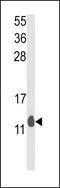 Proliferation And Apoptosis Adaptor Protein 15 antibody, GTX81197, GeneTex, Western Blot image 