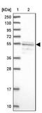 Serum Response Factor Binding Protein 1 antibody, NBP1-88518, Novus Biologicals, Western Blot image 