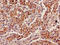 Indolethylamine N-Methyltransferase antibody, LS-C285541, Lifespan Biosciences, Immunohistochemistry paraffin image 