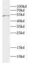 Dermokine antibody, FNab02425, FineTest, Western Blot image 