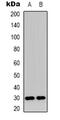 Chromosome 1 Open Reading Frame 35 antibody, abx133575, Abbexa, Western Blot image 