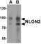Neuroligin 2 antibody, A06595, Boster Biological Technology, Western Blot image 