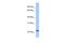 Mitochondrially Encoded NADH:Ubiquinone Oxidoreductase Core Subunit 6 antibody, PA5-43532, Invitrogen Antibodies, Western Blot image 