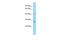 Notch 2 N-Terminal Like A antibody, A14024, Boster Biological Technology, Western Blot image 