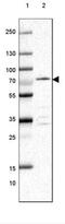 EF-Hand Domain Containing 2 antibody, NBP1-82102, Novus Biologicals, Western Blot image 