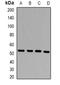 Presenilin 2 antibody, orb381989, Biorbyt, Western Blot image 