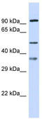 SGSH antibody, TA346525, Origene, Western Blot image 