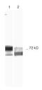 Matrix Metallopeptidase 2 antibody, MA1-16640, Invitrogen Antibodies, Western Blot image 