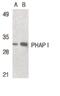 Acidic Nuclear Phosphoprotein 32 Family Member A antibody, PA5-20022, Invitrogen Antibodies, Western Blot image 