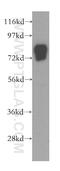 Vitronectin antibody, 15833-1-AP, Proteintech Group, Western Blot image 