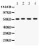 Glucose-6-Phosphate Dehydrogenase antibody, PB9198, Boster Biological Technology, Western Blot image 