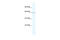 Zinc Finger And BTB Domain Containing 7C antibody, 27-730, ProSci, Western Blot image 