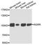 Insulin Receptor Related Receptor antibody, A10083, ABclonal Technology, Western Blot image 