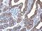 Keratin 5 antibody, PA5-29670, Invitrogen Antibodies, Immunohistochemistry paraffin image 