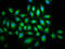 Mitogen-Activated Protein Kinase Kinase Kinase 9 antibody, CSB-PA013434LA01HU, Cusabio, Immunofluorescence image 