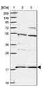 Ribosomal Protein S18 antibody, NBP2-13263, Novus Biologicals, Western Blot image 