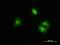 Clathrin Light Chain B antibody, H00001212-M01, Novus Biologicals, Immunofluorescence image 