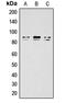 Component Of Inhibitor Of Nuclear Factor Kappa B Kinase Complex antibody, LS-C358452, Lifespan Biosciences, Western Blot image 