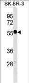 Endonuclease/Exonuclease/Phosphatase Family Domain Containing 1 antibody, PA5-48963, Invitrogen Antibodies, Western Blot image 