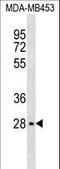 MTOR Associated Protein, LST8 Homolog antibody, LS-C159713, Lifespan Biosciences, Western Blot image 