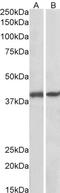 G Protein Subunit Alpha Q antibody, orb22529, Biorbyt, Western Blot image 