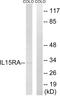 Interleukin 15 Receptor Subunit Alpha antibody, abx015087, Abbexa, Western Blot image 