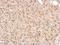 Inhibitor Of Nuclear Factor Kappa B Kinase Subunit Epsilon antibody, NBP1-33052, Novus Biologicals, Immunohistochemistry frozen image 