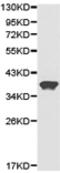 Actin Related Protein 2/3 Complex Subunit 1A antibody, TA324073, Origene, Western Blot image 