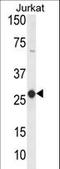 CD160 Molecule antibody, LS-C168514, Lifespan Biosciences, Western Blot image 