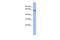 Gamma-Aminobutyric Acid Type A Receptor Epsilon Subunit antibody, PA5-41023, Invitrogen Antibodies, Western Blot image 