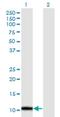 Alpha Hemoglobin Stabilizing Protein antibody, H00051327-M32, Novus Biologicals, Western Blot image 