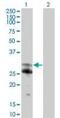 NFAT Activating Protein With ITAM Motif 1 antibody, PA5-23106, Invitrogen Antibodies, Western Blot image 