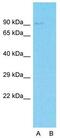 Mitotic Spindle Positioning antibody, GTX45579, GeneTex, Western Blot image 