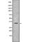 Homeobox A11 antibody, abx216010, Abbexa, Western Blot image 